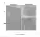 Fig. 17 - Dnazyme for silencing the expression of EGFR