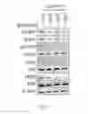 Fig. 31 - Dnazyme for silencing the expression of EGFR