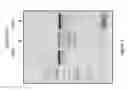 Fig. 04 - METHODS FOR NON-TRANSGENIC GENOME EDITING IN PLANTS