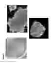 Fig. 06 - Generation of induced pluripotent stem cells from normal human mammary epithelial cells