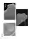 Fig. 07 - Generation of induced pluripotent stem cells from normal human mammary epithelial cells