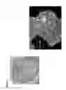 Fig. 08 - Generation of induced pluripotent stem cells from normal human mammary epithelial cells