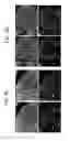 Fig. 07 - Endothelial-targeted Adenoviral Vectors, Methods and Uses Therefor