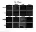 Fig. 11 - Endothelial-targeted Adenoviral Vectors, Methods and Uses Therefor