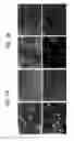 Fig. 12 - Endothelial-targeted Adenoviral Vectors, Methods and Uses Therefor