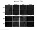 Fig. 16 - Endothelial-targeted Adenoviral Vectors, Methods and Uses Therefor
