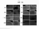 Fig. 18 - Endothelial-targeted Adenoviral Vectors, Methods and Uses Therefor