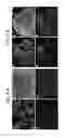 Fig. 22 - Endothelial-targeted Adenoviral Vectors, Methods and Uses Therefor