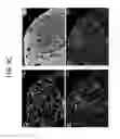 Fig. 23 - Endothelial-targeted Adenoviral Vectors, Methods and Uses Therefor
