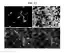 Fig. 26 - Endothelial-targeted Adenoviral Vectors, Methods and Uses Therefor