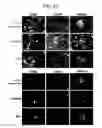 Fig. 47 - Endothelial-targeted Adenoviral Vectors, Methods and Uses Therefor