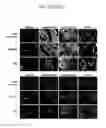 Fig. 50 - Endothelial-targeted Adenoviral Vectors, Methods and Uses Therefor