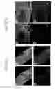 Fig. 55 - Endothelial-targeted Adenoviral Vectors, Methods and Uses Therefor