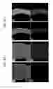Fig. 56 - Endothelial-targeted Adenoviral Vectors, Methods and Uses Therefor