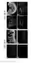 Fig. 58 - Endothelial-targeted Adenoviral Vectors, Methods and Uses Therefor