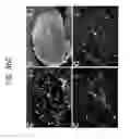 Fig. 61 - Endothelial-targeted Adenoviral Vectors, Methods and Uses Therefor