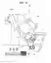 Fig. 15 - Method of processing liquid biological material