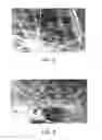 Fig. 04 - Hybrid nonwoven mats and methods