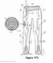 Fig. 55 - Thermoplastic non-woven textile elements