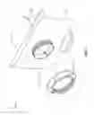 Fig. 05 - Threaded attachment system for wall-mounted pool skimmer