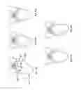 Fig. 12 - Window arrangement comprising a plurality of window systems and at least one accessory element
