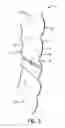 Fig. 04 - COVERING FOR AN ARCHITECTURAL OPENING HAVING COVED SLATS