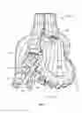 Fig. 03 - LOW COLLISION DAMAGE BIT