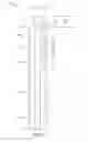 Fig. 02 - Gas lift valve assemblies having fluid flow barrier and methods of assembling same