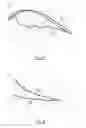 Fig. 04 - Reduction of turbofan noise