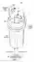 Fig. 02 - Two-dimensional igniter for testing in-cylinder gas velocity and/or gas composition