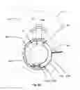 Fig. 09 - Tensioner with improved damping