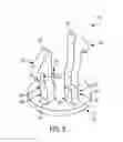 Fig. 10 - Pressure sensitive valve assembly incorporating enhanced retention legs and fluid filter including the same