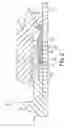 Fig. 03 - HIGH STRENGTH FLEXIBLE FERRULE