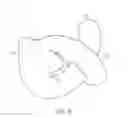 Fig. 04 - String damper having aperture
