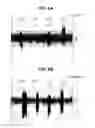 Fig. 07 - Misfire detection with crankshaft vibrations