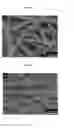 Fig. 05 - Substrate for surfaced enhanced raman scattering, fabrication method for the same and analyzing method using the same