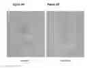 Fig. 03 - Measuring antiplatelet activity
