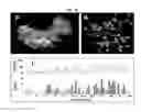 Fig. 16 - NOVEL BIOMARKER DETECTION WITH MOLECULAR IMPRINTS
