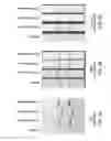 Fig. 05 - Porous membranes with a polymer grafting, methods and uses thereof