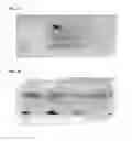 Fig. 03 - METHOD OF DETECTING AND IDENTIFYING CIRCULATING ANTIGENS IN HUMAN BIOLOGICAL SAMPLES
