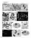 Fig. 03 - CLASSIFICATION SYSTEM, METHODS AND KIT FOR CLASSIFYING, PREDICTING AND TREATING BREAST CANCER