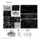 Fig. 05 - CLASSIFICATION SYSTEM, METHODS AND KIT FOR CLASSIFYING, PREDICTING AND TREATING BREAST CANCER