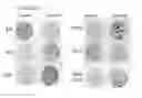 Fig. 18 - CLASSIFICATION SYSTEM, METHODS AND KIT FOR CLASSIFYING, PREDICTING AND TREATING BREAST CANCER