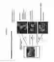 Fig. 08 - Therapeutic agent, method of treatment and method for predicting the severity of systemic inflammatory response syndrome (SIRS), diseases caused or accompanied by neutrophil activation