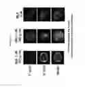 Fig. 09 - Therapeutic agent, method of treatment and method for predicting the severity of systemic inflammatory response syndrome (SIRS), diseases caused or accompanied by neutrophil activation