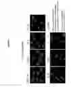 Fig. 10 - Therapeutic agent, method of treatment and method for predicting the severity of systemic inflammatory response syndrome (SIRS), diseases caused or accompanied by neutrophil activation