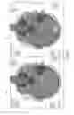 Fig. 05 - Compressed sensing reconstruction for multi-slice and multi-slab acquisitions