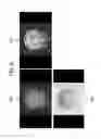 Fig. 07 - CORRECTED MAGNETIC RESONANCE IMAGING USING COIL SENSITIVITIES