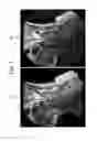 Fig. 08 - CORRECTED MAGNETIC RESONANCE IMAGING USING COIL SENSITIVITIES