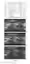 Fig. 15 - Enhanced visualization of geologic features in 3D seismic survey data using high definition frequency decomposition (HDFD)